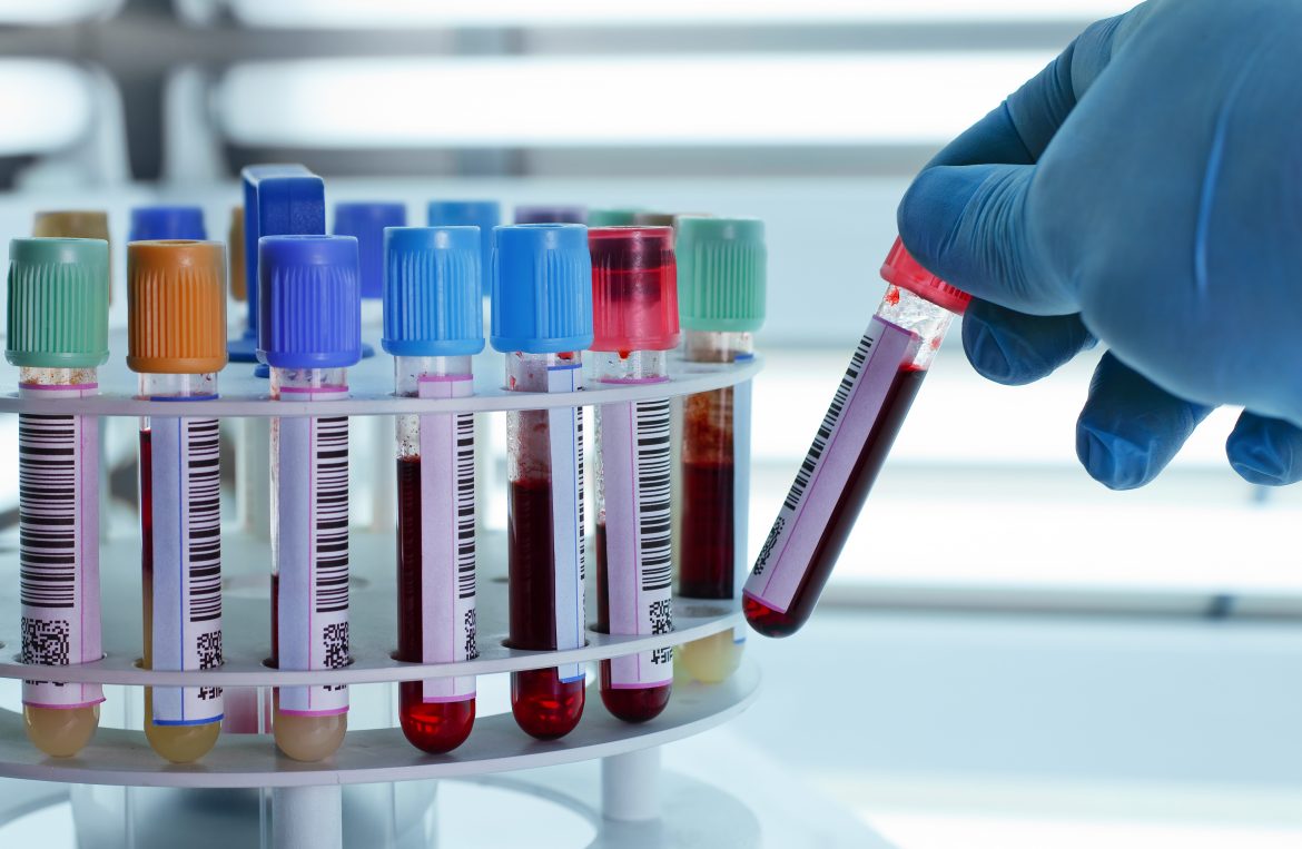 Blood tubes for centrifuging Aletra Capital Partners B.V.